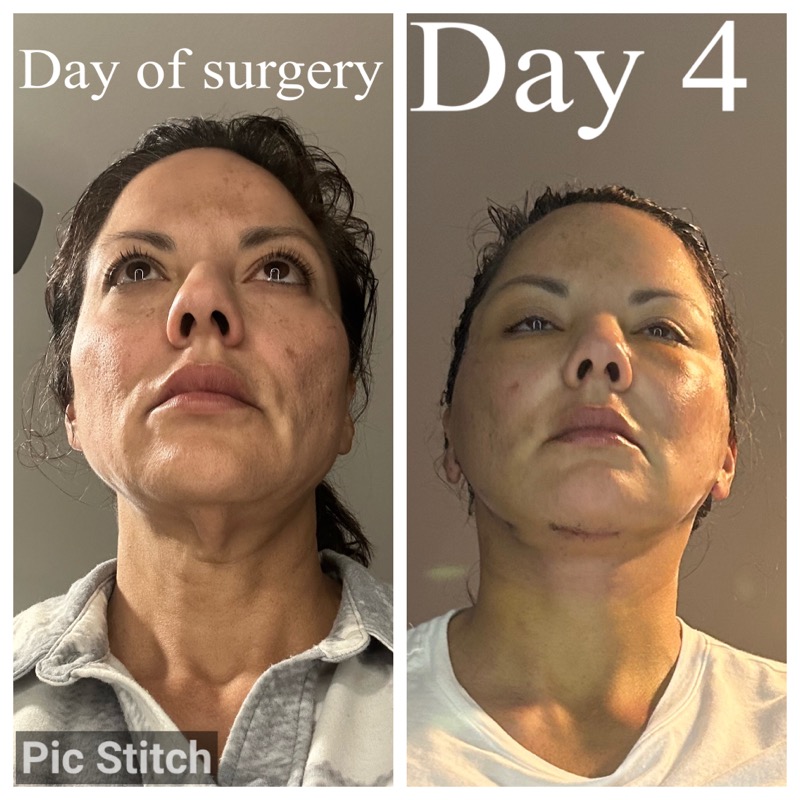 Selfie Testimonials  Bellevueand Bellevue