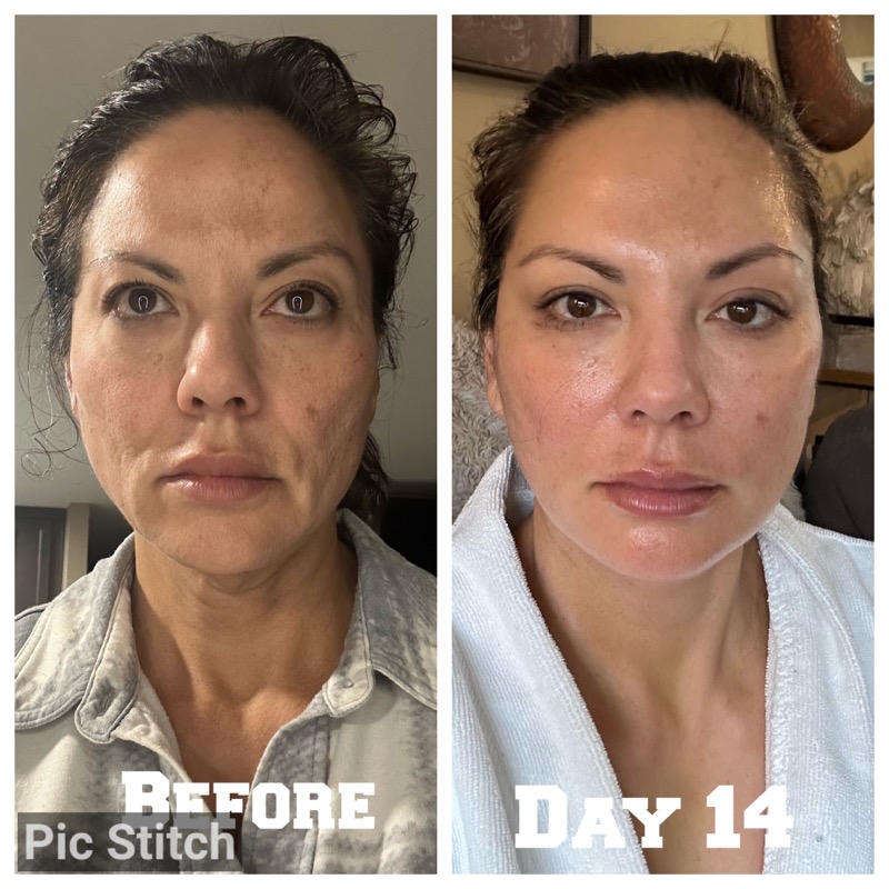 Selfie Testimonials  Bellevueand Bellevue