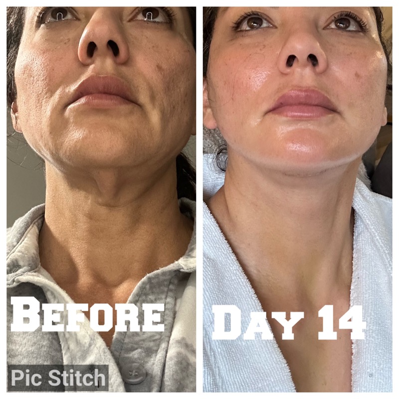 Selfie Testimonials  Bellevueand Bellevue