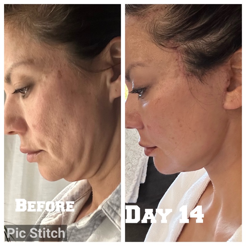 Selfie Testimonials  Bellevueand Bellevue