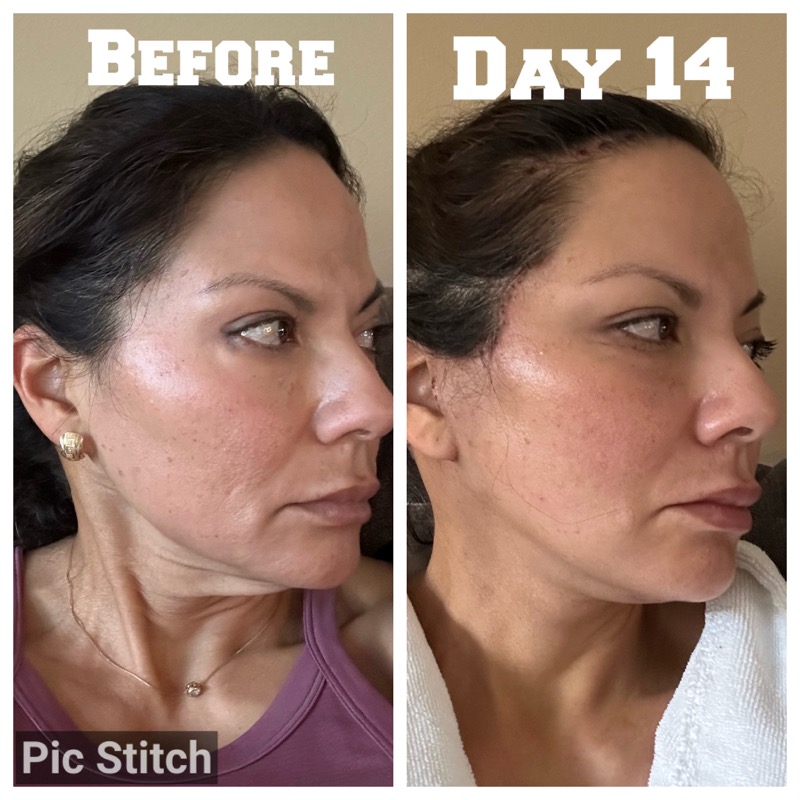 Selfie Testimonials  Bellevueand Bellevue