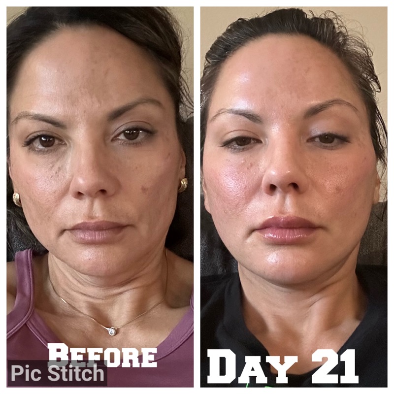 Selfie Testimonials  Bellevueand Bellevue