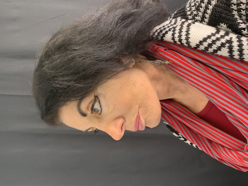 Deep Plane Facelift Before & After Image