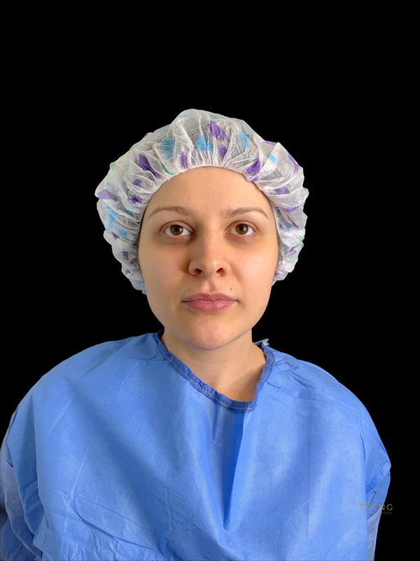 Facial Fat Transfer Before & After Image