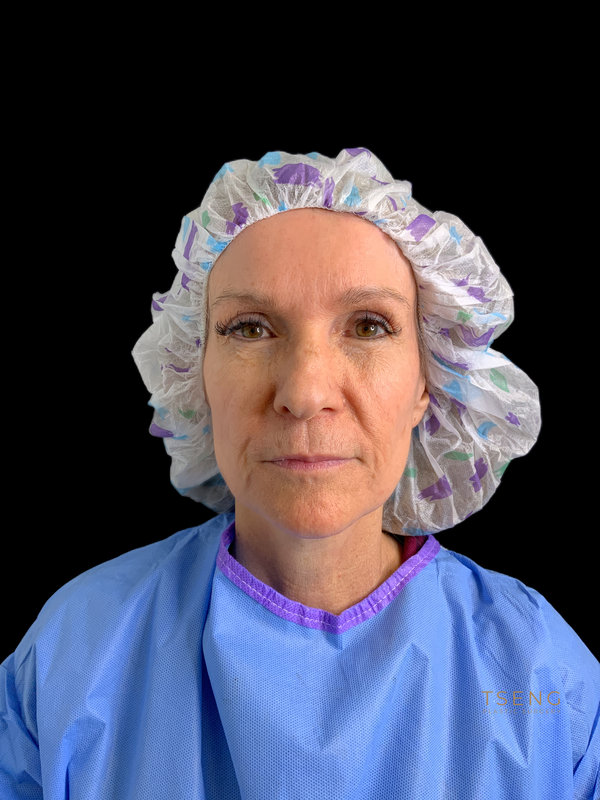 Preservation Facelift Before & After Image