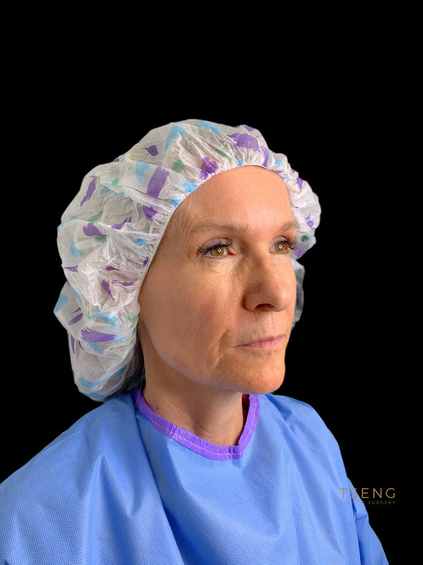 Preservation Facelift Before & After Image