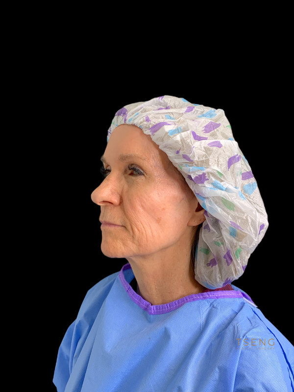 Preservation Facelift Before & After Image