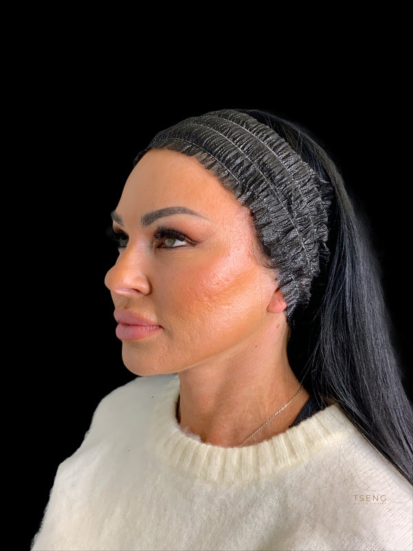 Preservation Facelift Before & After Image