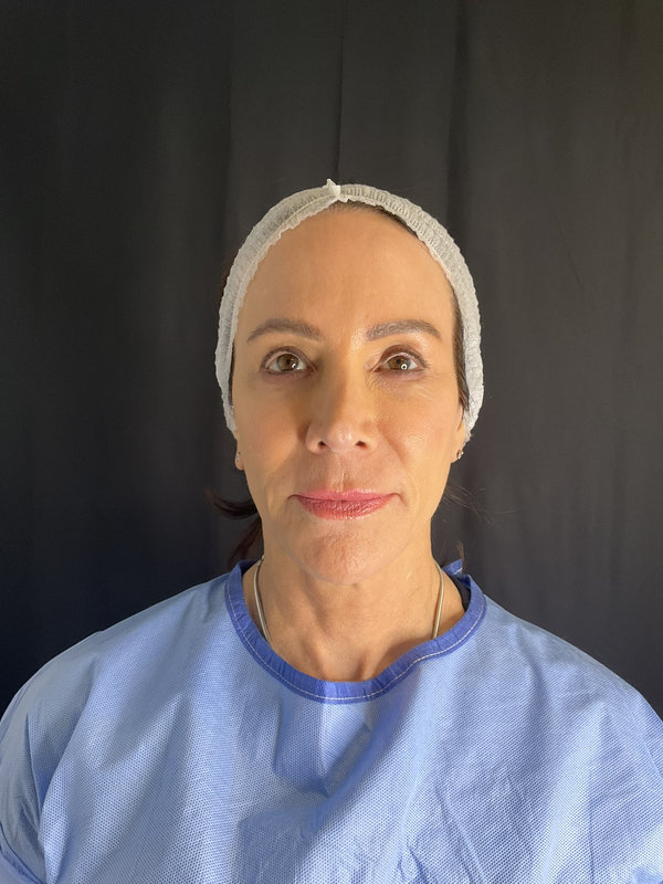 Preservation Facelift Before & After Image