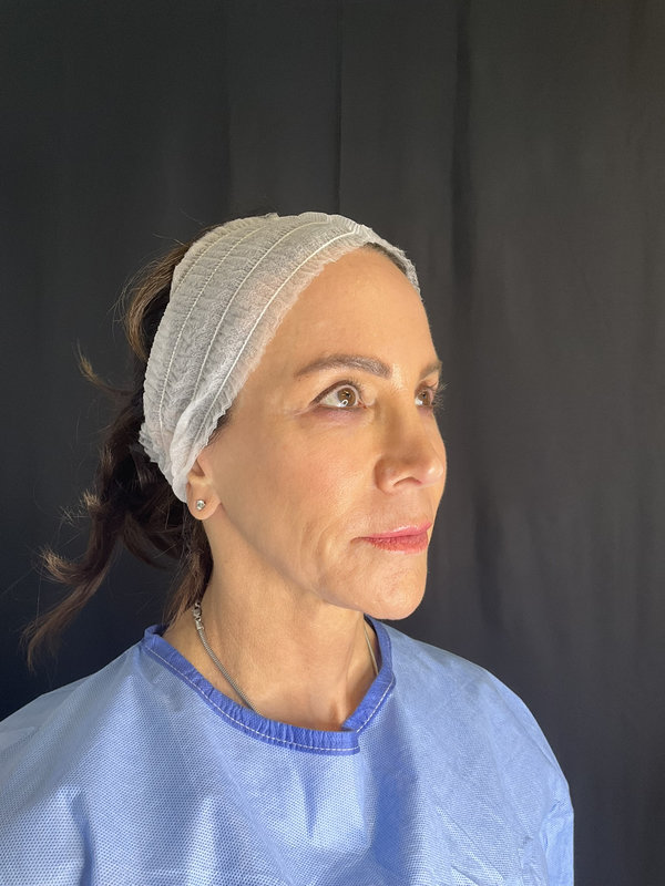 Preservation Facelift Before & After Image