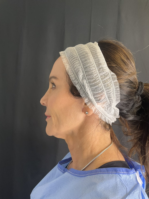 Preservation Facelift Before & After Image