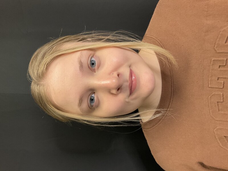 Rhinoplasty Before & After Image